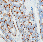 Chromogranin A Antibody in Immunohistochemistry (Paraffin) (IHC (P))