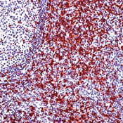 CD5 Antibody in Immunohistochemistry (Paraffin) (IHC (P))