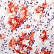 CD205 Antibody in Immunohistochemistry (Paraffin) (IHC (P))