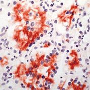 CD205 Antibody in Immunohistochemistry (Paraffin) (IHC (P))