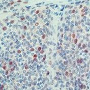 Cdk2 Antibody in Immunohistochemistry (Paraffin) (IHC (P))
