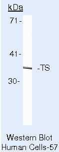 Thymidylate Synthase Antibody in Western Blot (WB)
