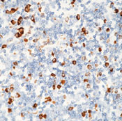 Plasma Cell Antibody in Immunohistochemistry (Paraffin) (IHC (P))
