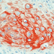Cytokeratin 17 Antibody in Immunohistochemistry (Paraffin) (IHC (P))