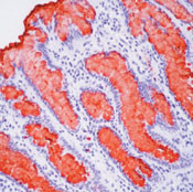 MUC5AC Antibody in Immunohistochemistry (IHC)