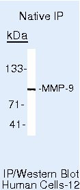 MMP9 Antibody in Immunoprecipitation (IP)