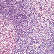 CBP Antibody in Immunohistochemistry (Paraffin) (IHC (P))