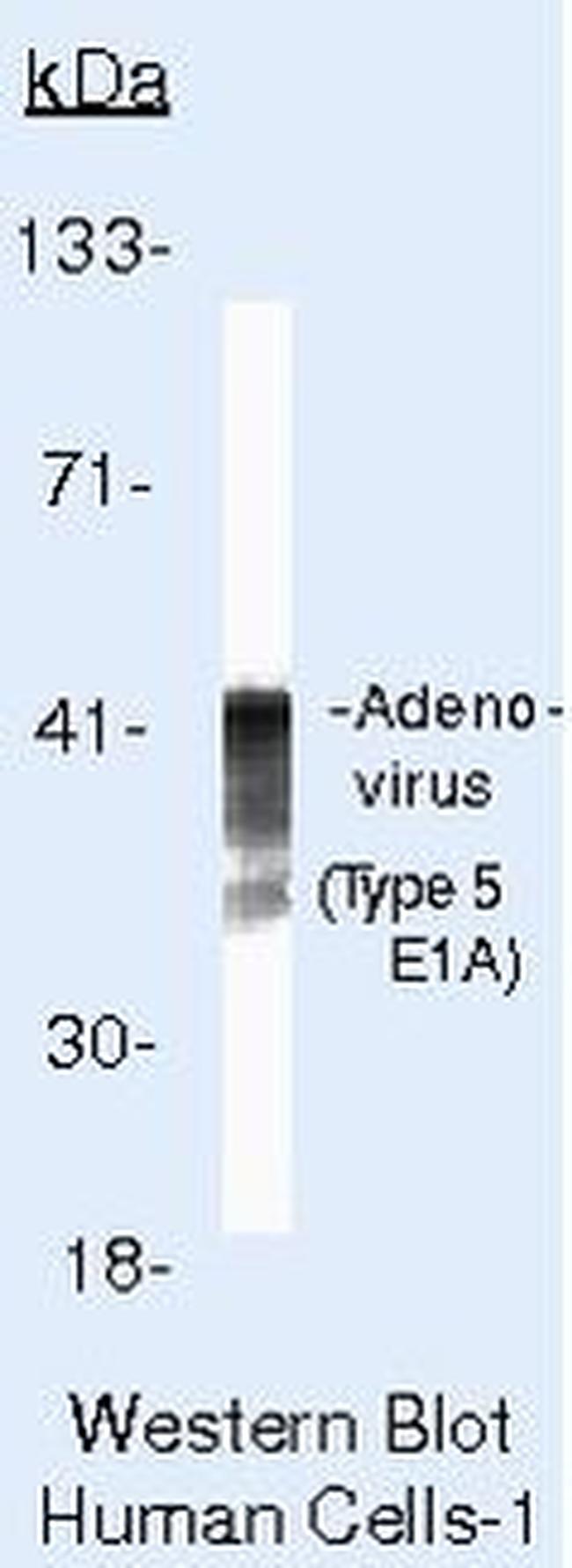 Adenovirus Type 5 Antibody in Western Blot (WB)