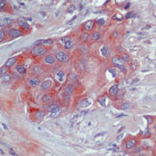 ErbB4 Antibody in Immunohistochemistry (Paraffin) (IHC (P))