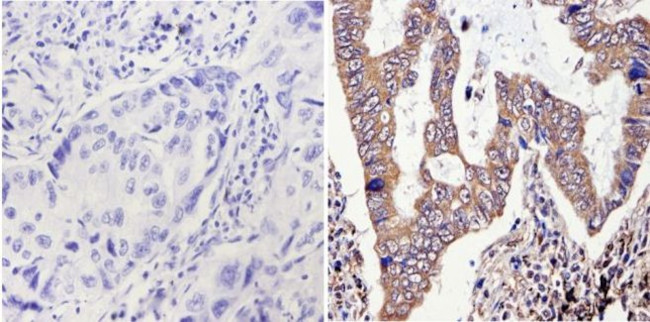 ERCC1 Antibody in Immunohistochemistry (Paraffin) (IHC (P))