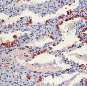 SFTPB Precursor Antibody in Immunohistochemistry (Paraffin) (IHC (P))