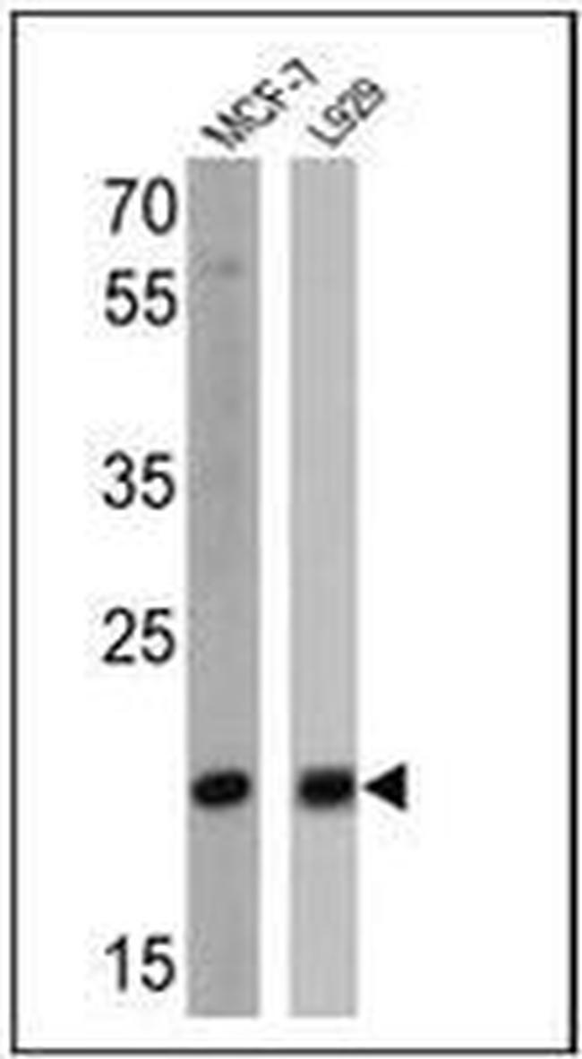 Bax Antibody in Western Blot (WB)