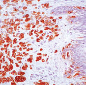 Melan-A Antibody in Immunohistochemistry (Paraffin) (IHC (P))