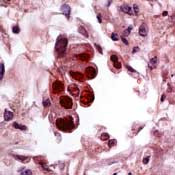 Cytomegalovirus Antibody in Immunohistochemistry (IHC)