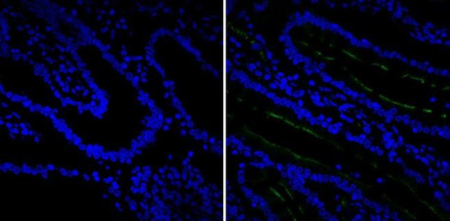 CD10 Antibody in Immunohistochemistry (Paraffin) (IHC (P))