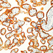 Placental Alkaline Phosphatase Antibody in Immunohistochemistry (Paraffin) (IHC (P))