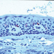 CD1a Antibody in Immunohistochemistry (Paraffin) (IHC (P))
