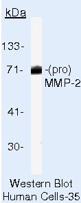 MMP2 Antibody in Western Blot (WB)