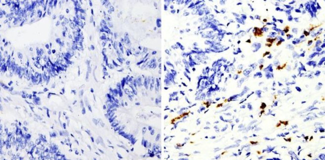 MMP9 Antibody in Immunohistochemistry (Paraffin) (IHC (P))