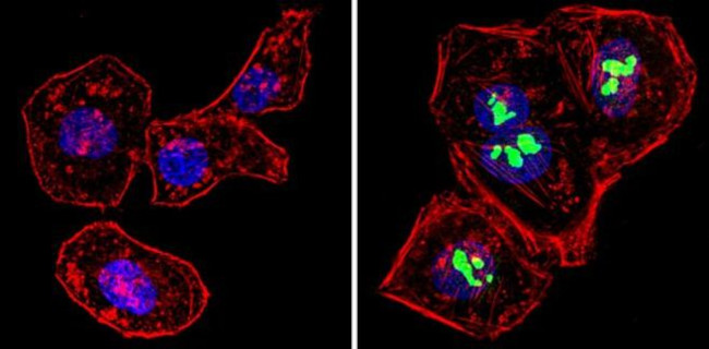 p14ARF Antibody in Immunocytochemistry (ICC/IF)