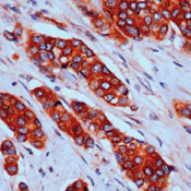p130Cas Antibody in Immunohistochemistry (Paraffin) (IHC (P))