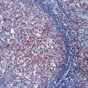 CDKN2C Antibody in Immunohistochemistry (Paraffin) (IHC (P))