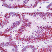 p130 Antibody in Immunohistochemistry (Paraffin) (IHC (P))