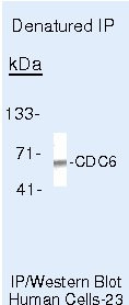 Cdc6 Antibody in Immunoprecipitation (IP)