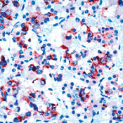 Prolactin Antibody in Immunohistochemistry (IHC)