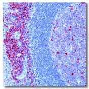 CD38 Antibody in Immunohistochemistry (Paraffin) (IHC (P))