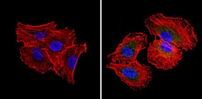 RAD51 Antibody in Immunocytochemistry (ICC/IF)