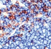 CD3/CD20 Antibody in Immunohistochemistry (Paraffin) (IHC (P))