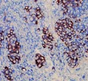 Vimentin Antibody in Immunohistochemistry (Paraffin) (IHC (P))