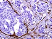 Calponin 1 Antibody in Immunohistochemistry (Paraffin) (IHC (P))