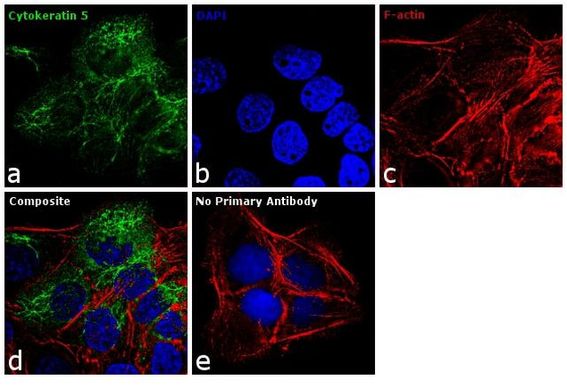 Cytokeratin 5 Antibody in Immunocytochemistry (ICC/IF)