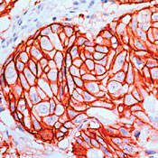 ErbB2 (HER-2) Antibody in Immunohistochemistry (Paraffin) (IHC (P))