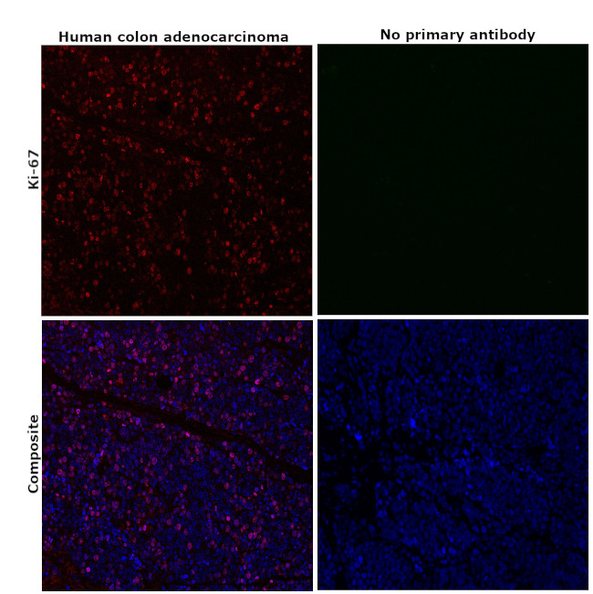 Ki-67 Antibody in Immunohistochemistry (Paraffin) (IHC (P))