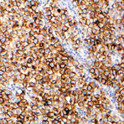 Placental Alkaline Phosphatase Antibody in Immunohistochemistry (IHC)