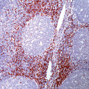 CD8 Antibody in Immunohistochemistry (Paraffin) (IHC (P))