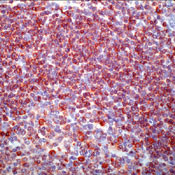 CD79a Antibody in Immunohistochemistry (Paraffin) (IHC (P))