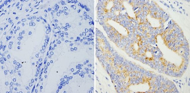 AMACR Antibody in Immunohistochemistry (Paraffin) (IHC (P))