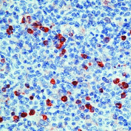 GRP94 Antibody in Immunohistochemistry (Paraffin) (IHC (P))