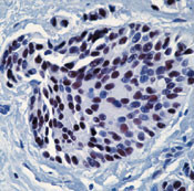 HSF1 Antibody in Immunohistochemistry (IHC)