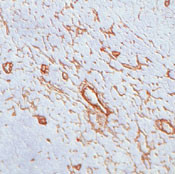 Perlecan Antibody in Immunohistochemistry (IHC)