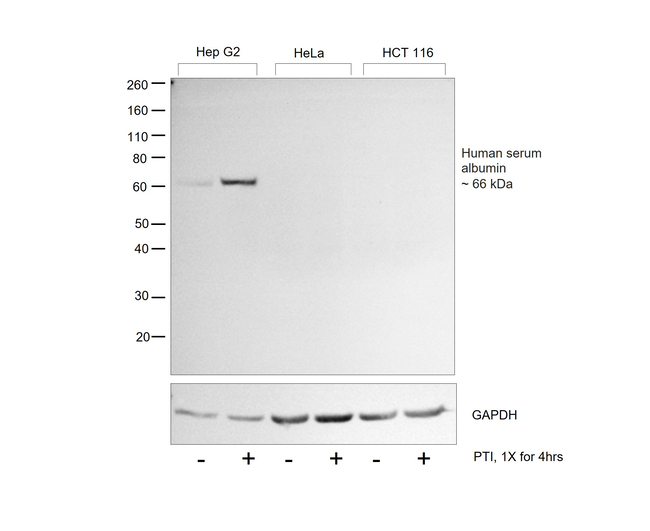 Human Serum Albumin Antibody in Western Blot (WB)
