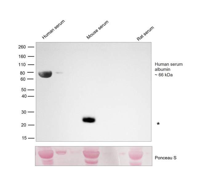 Human Serum Albumin Antibody in Western Blot (WB)