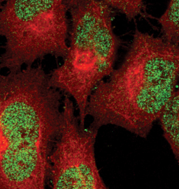 Phospho-STAT5 alpha (Tyr694) Antibody in Immunocytochemistry (ICC/IF)
