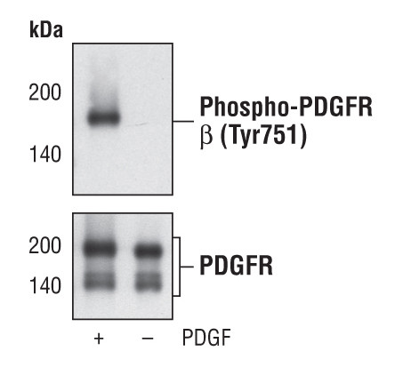 Phospho-PDGFRB (Tyr751) Antibody in Western Blot (WB)