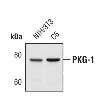 cGKI Antibody in Western Blot (WB)