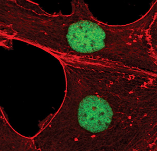 EVI1 Antibody in Immunocytochemistry (ICC/IF)